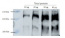 RPB2 | DNA-directed RNA polymerase II subunit 2